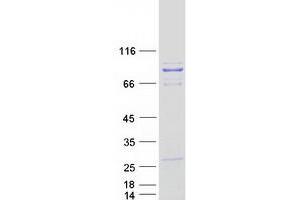 Western Blotting (WB) image for PDX1 C-terminal Inhibiting Factor 1 (PCIF1) protein (Myc-DYKDDDDK Tag) (ABIN2728408)