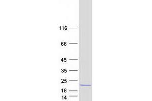 Western Blotting (WB) image for Glyoxalase Domain Containing 5 (GLOD5) protein (Myc-DYKDDDDK Tag) (ABIN2722055)