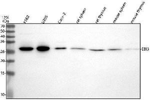 Western blot analysis of EBI3 using anti-EBI3 antibody (ABIN7604706).