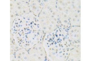 Immunohistochemistry of paraffin-embedded Rat kidney using KAT2A Polyclonal Antibody at dilution of 1:100 (40x lens). (KAT2A 抗体)