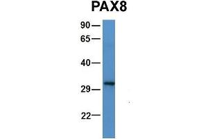 Host:  Rabbit  Target Name:  PAX8  Sample Type:  Human 721_B  Antibody Dilution:  1. (PAX5 抗体  (N-Term))
