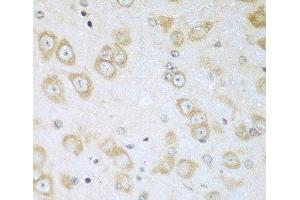Immunohistochemistry of paraffin-embedded Mouse brain using ACOX1 Polyclonal Antibody at dilution of 1:100 (40x lens). (ACOX1 抗体)