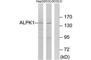 Western blot analysis of extracts from COLO/HepG2 cells, using ALPK1 Antibody. (ALPK1 抗体  (AA 11-60))