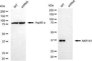 Western blotting analysis using AKR1A1 antibody (ABIN7797569).