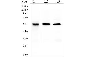 Western blot analysis of RbAp48 using anti-RbAp48 antibody (ABIN5692929).