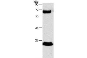 Western Blot analysis of Human fetal liver tissue using GGT1 Polyclonal Antibody at dilution of 1:300 (GGT1 抗体)