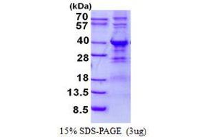 Image no. 1 for WW Domain Binding Protein 2 (WBP2) (AA 1-261) protein (His tag) (ABIN1098390)