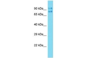 Western Blotting (WB) image for anti-Tigger Transposable Element Derived 5 (TIGD5) (N-Term) antibody (ABIN2774522) (TIGD5 抗体  (N-Term))