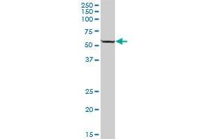 TYRP1 MaxPab polyclonal antibody. (Tyrosinase-Related Protein 1 抗体  (AA 1-537))