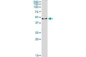 Western Blotting (WB) image for anti-Interleukin 1 Receptor, Type II (IL1R2) (AA 1-398) antibody (ABIN521667)