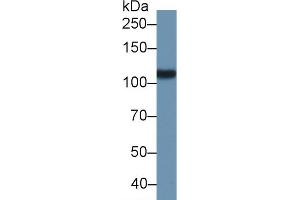 Western Blotting (WB) image for anti-Folate Hydrolase (Prostate-Specific Membrane Antigen) 1 (FOLH1) (AA 275-588) antibody (ABIN7443899)