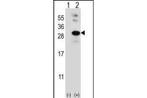 Western blot analysis of GLO1 (arrow) using rabbit polyclonal GLO1 Antibody (N-term) (ABIN390591 and ABIN2840910).