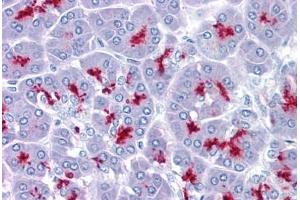 Pancreas, Human: Formalin-Fixed, Paraffin-Embedded (FFPE) (MUC1 抗体)