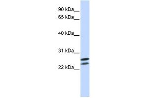 WB Suggested Anti-HOXB4 Antibody   Titration: 1 ug/ml   Positive Control: Jurkat Whole Cell (HOXB4 抗体  (N-Term))