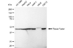Western blotting analysis using Tissue Factor antibody (ABIN7798107).