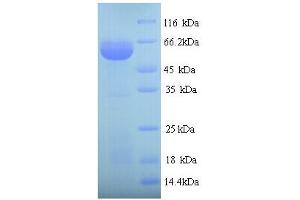 SDS-PAGE (SDS) image for Prolyl 4-Hydroxylase, beta Polypeptide (P4HB) (AA 18-508) protein (His tag) (ABIN5713710) (P4HB Protein (AA 18-508) (His tag))