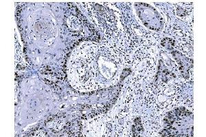 IHC analysis of Ki67 using anti-Ki67 antibody (ABIN7601101).