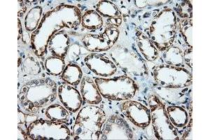 Immunohistochemical staining of paraffin-embedded liver tissue using anti-NME4 mouse monoclonal antibody. (NME4 抗体)