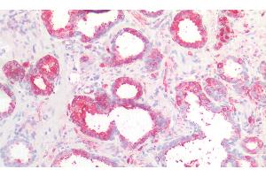 Detection of CTNNbIP1 in Human Prostate Tissue using Polyclonal Antibody to Catenin Beta Interacting Protein 1 (CTNNbIP1) (CTNNBIP1 抗体  (AA 1-81))