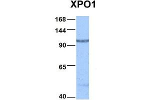 Host:  Rabbit  Target Name:  XPO1  Sample Type:  Hela  Antibody Dilution:  1. (XPO1 抗体  (C-Term))