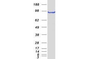 Western Blotting (WB) image for Zinc Fingers and Homeoboxes 2 (ZHX2) protein (Myc-DYKDDDDK Tag) (ABIN2735880)