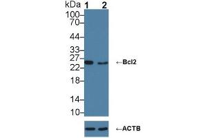 Western blot analysis of (1) Wild-type HL-60 cell lysate, and (2) Bcl2 knockout HL-60 cell lysate, using Rabbit Anti-Mouse BCL2 Antibody (5 µg/ml) and HRP-conjugated Goat Anti-Mouse antibody (abx400001, 0. (Bcl-2 抗体  (AA 2-208))