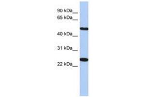 Image no. 1 for anti-Transmembrane Protein 161B (TMEM161B) (AA 71-120) antibody (ABIN6741235) (TMEM161B 抗体  (AA 71-120))