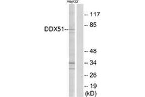 Western blot analysis of extracts from HepG2 cells, using DDX51 Antibody. (DDX51 抗体  (AA 617-666))