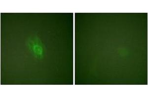 Immunofluorescence analysis of HeLa cells treated with TNF-a 20nM 15', using IkappaB-beta (Phospho-Ser23) Antibody. (NFKBIB 抗体  (pSer23))