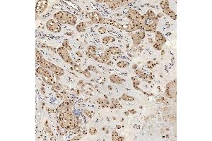 IHC analysis of U1A/SNRPA using anti-U1A/SNRPA antibody (ABIN7600891). (SNRPA1 抗体  (AA 25-218))