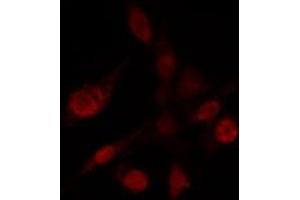 ABIN6272432 staining Hela by IF/ICC. (Sp3/4 抗体)