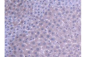 DAB staining on IHC-P; Samples: Mouse Liver Tissue (ABAT 抗体  (AA 236-500))