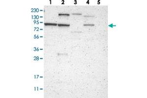 Western blot analysis of Lane 1: RT-4, Lane 2: U-251 MG, Lane 3: Human Plasma, Lane 4: Liver, Lane 5: Tonsil with C1orf71 polyclonal antibody . (CNST 抗体)