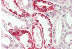 Immunohistochemistry (IHC) image for anti-Glycine Amidinotransferase (L-Arginine:glycine Amidinotransferase) (GATM) (Middle Region) antibody (ABIN2783416)