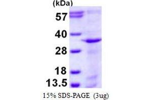 Syntaxin 12 (STX12) (AA 1-248) protein (His tag)