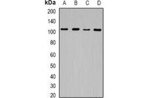 Western blot analysis of JHDM1D expression in Hela (A), HEK293T (B), mouse spleen (C), rat brain (D) whole cell lysates. (JHDM1D 抗体)
