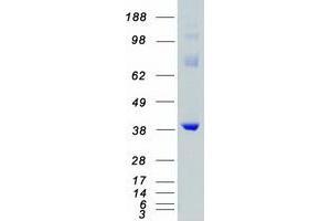 Western Blotting (WB) image for Mitogen-Activated Protein Kinase Kinase 6 (MAP2K6) protein (Myc-DYKDDDDK Tag) (ABIN2725394)