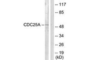 Western blot analysis of extracts from HepG2 cells, using CDC25A (Ab-124) Antibody. (CDC25A 抗体  (AA 90-139))
