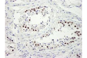 anti-ZW10 Interactor (ZWINT) (C-Term) antibody