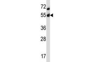 Akt2 antibody western blot analysis in MCF-7 lysate.