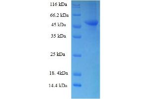 SDS-PAGE (SDS) image for Ribokinase (RBKS) (AA 2-322) protein (His-SUMO Tag) (ABIN5710217)