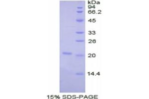 SDS-PAGE of Protein Standard from the Kit (Highly purified E. (Haptoglobin ELISA 试剂盒)