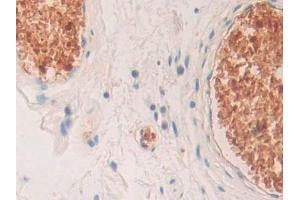 Immunohistochemistry (IHC) image for anti-Hemoglobin, delta (HBd) (AA 1-143) antibody (ABIN7443527)