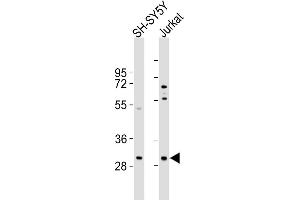 All lanes : Anti-TRMT61A Antibody (N-term) at 1:1000 dilution Lane 1: SH-SY5Y whole cell lysates Lane 2: Jurkat whole cell lysates Lysates/proteins at 20 μg per lane. (TRMT61A 抗体  (N-Term))