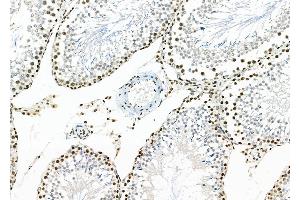 ABIN6259030 and ABIN6273465 at 1/100 staining Rat testis tissue by IHC-P. (APITD1 抗体  (C-Term))