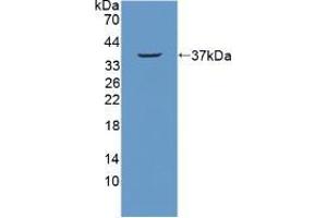 Western blot analysis of recombinant Mouse NUP214. (NUP214 抗体  (AA 601-868))