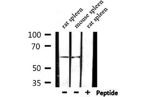 Western blot analysis of extracts from rat spleen,mouse spleen, using Cytochrome P450 2D6 Antibody. (CYP2D6 抗体)