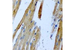 Immunohistochemical analysis of GnT-III staining in rat heart formalin fixed paraffin embedded tissue section. (MGAT3 抗体)