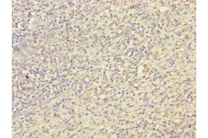Immunohistochemistry of paraffin-embedded human spleen tissue using ABIN7172018 at dilution of 1:100 (TXNRD1 抗体  (AA 1-497))