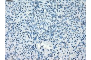 Immunohistochemical staining of paraffin-embedded endometrium tissue using anti-PDE10A mouse monoclonal antibody. (PDE10A 抗体)